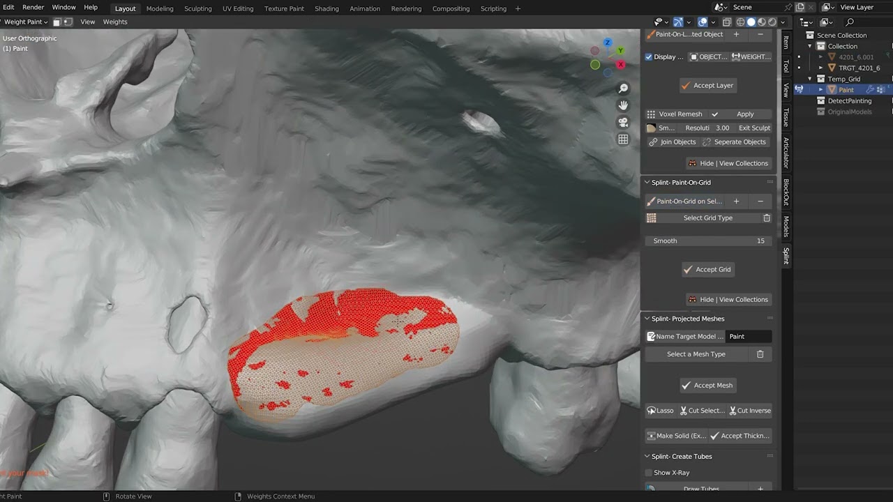 To make a customized titanium mesh by Blue Sky Plan and blenderfordental