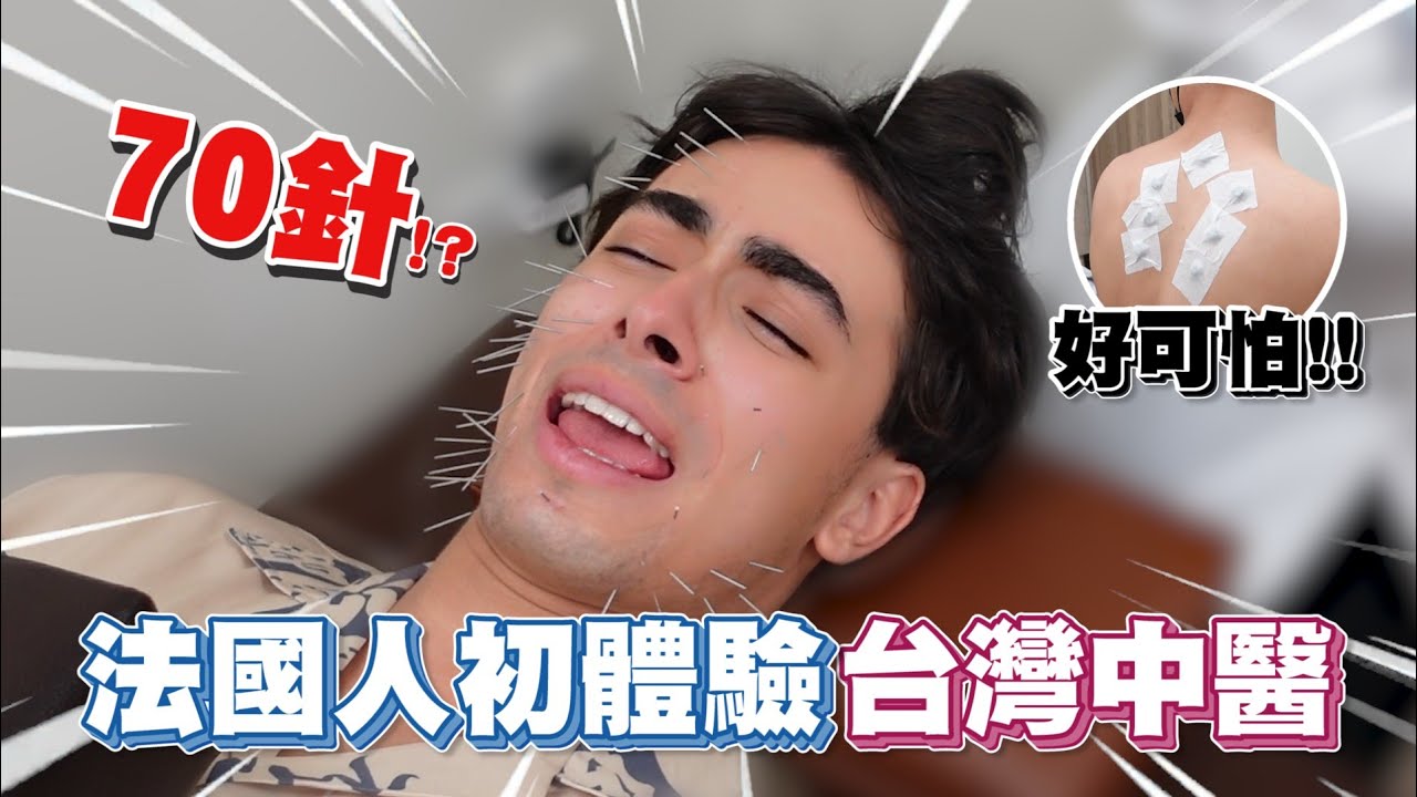 ⚠️法國媽媽：「中醫好危險，針灸會感染的，我不准你去做😡❗」我偷偷去體驗中醫😰照片嚇死全家人❗對中醫的印象完全改變了❓