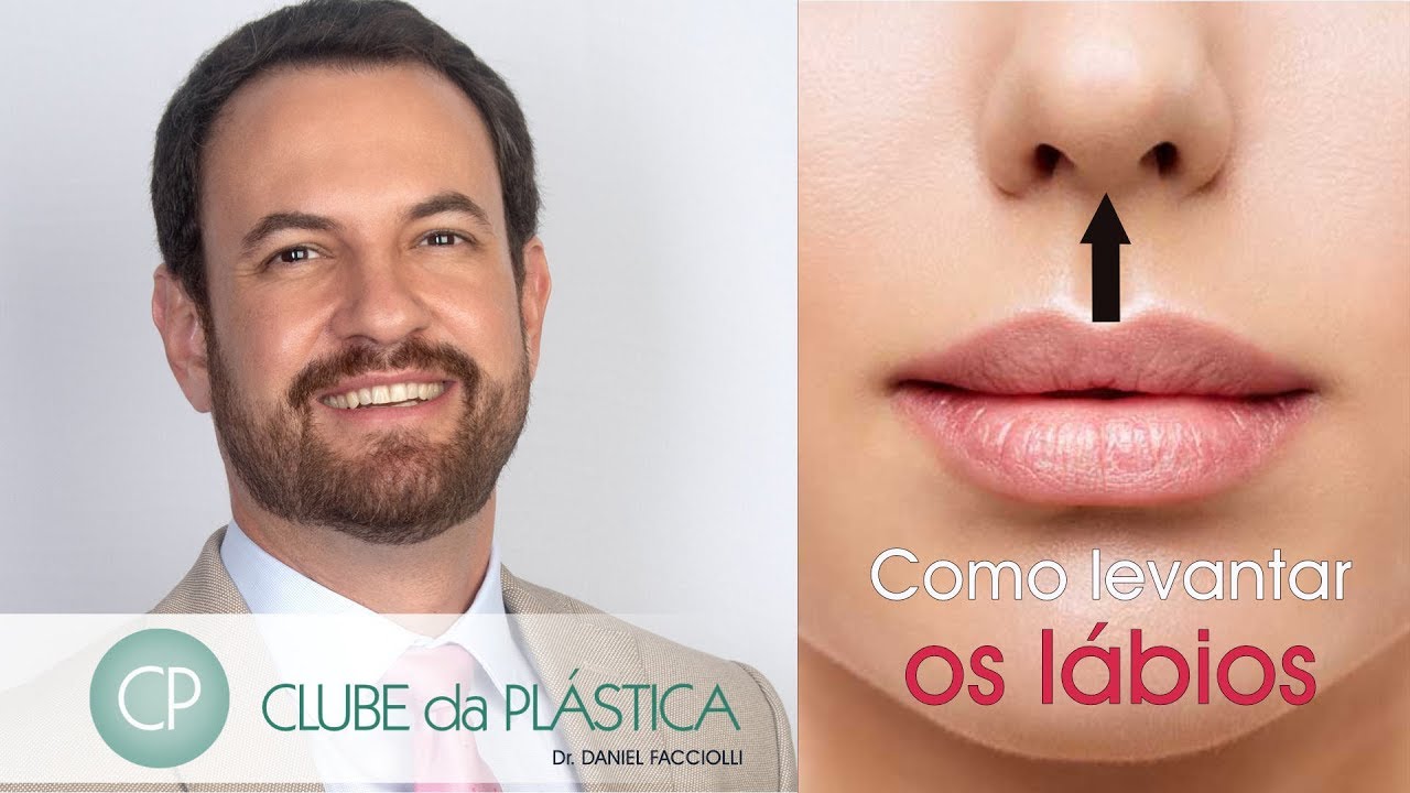 Clube da Plástica: Como levantar os lábios (lip-lift)
