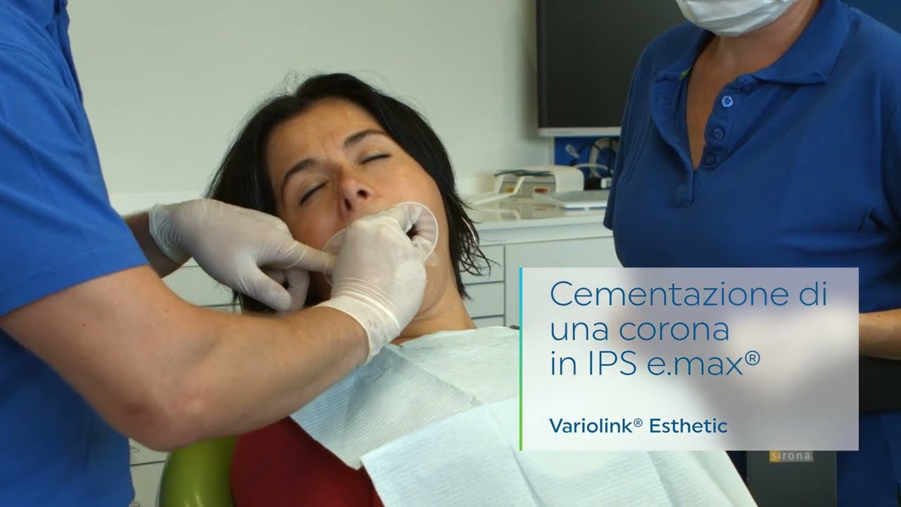 Variolink&reg; Esthetic - Cementazione di una corona in IPS e.max&reg; | IT | Ivoclar