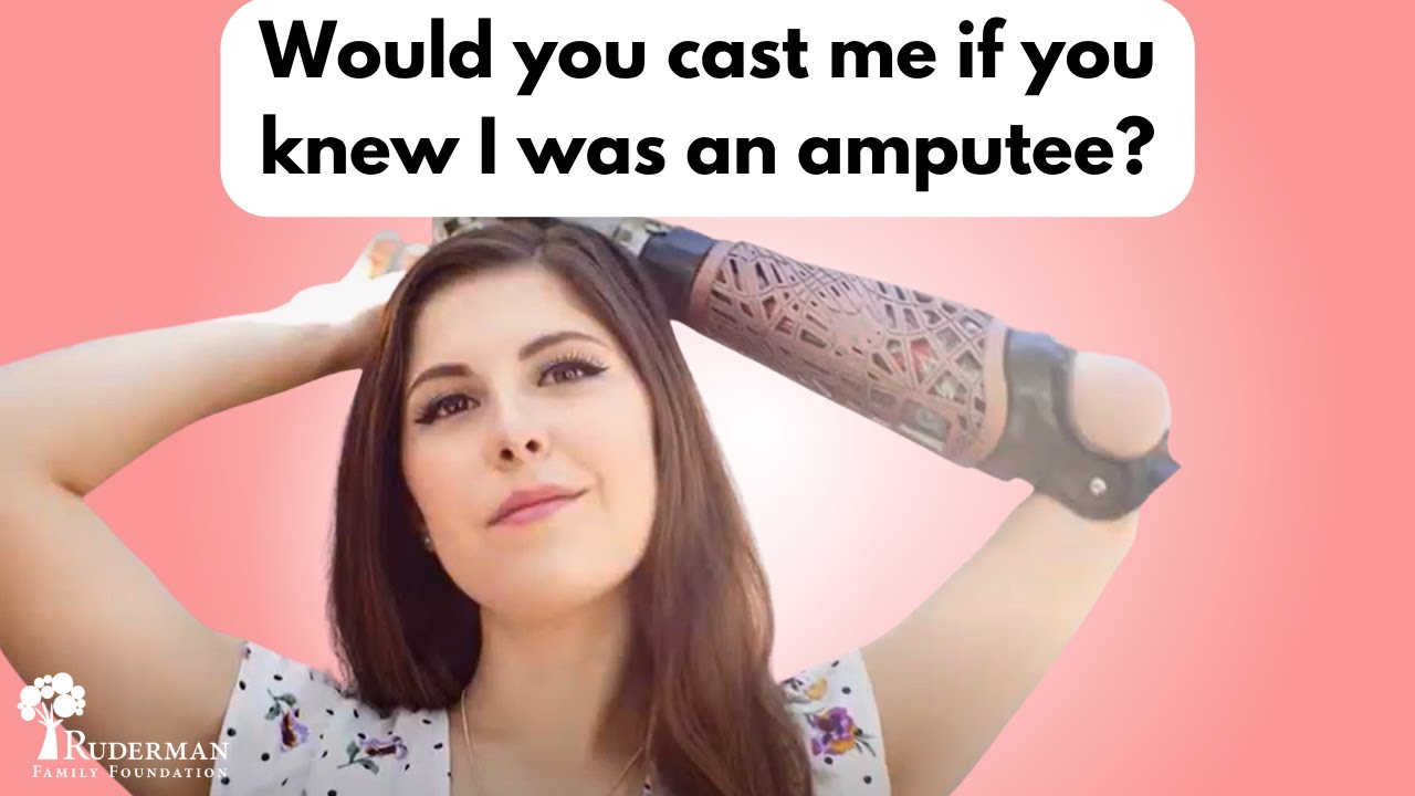 Would you cast me if you knew I was an amputee? Model and actress Angel Giuffria