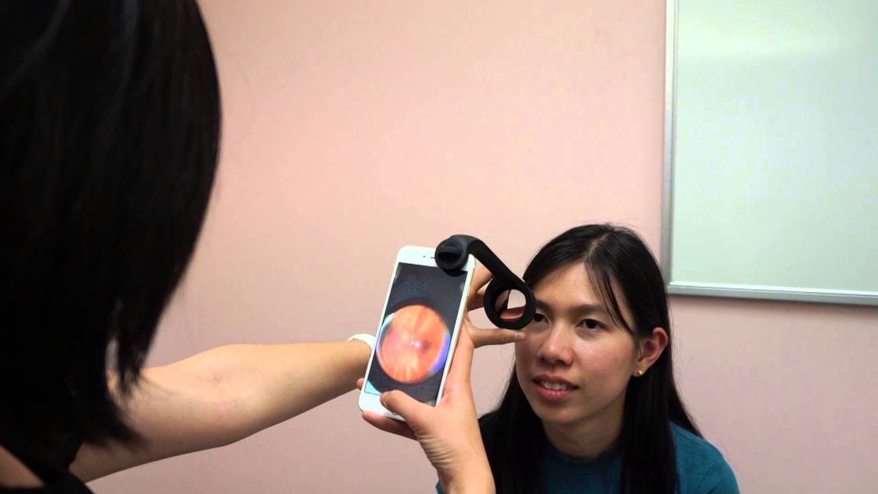visoScope Smartphone Ophthalmoscope