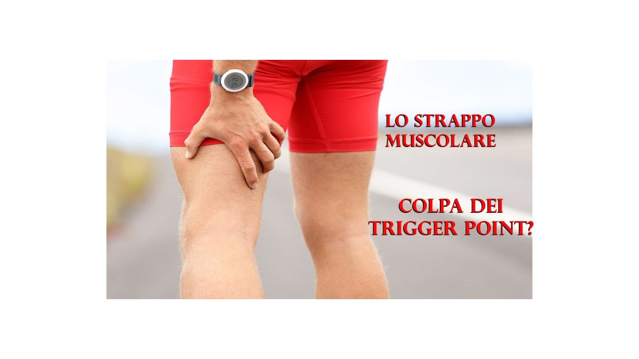 Strappo muscolare e coinvolgimento dei trigger point