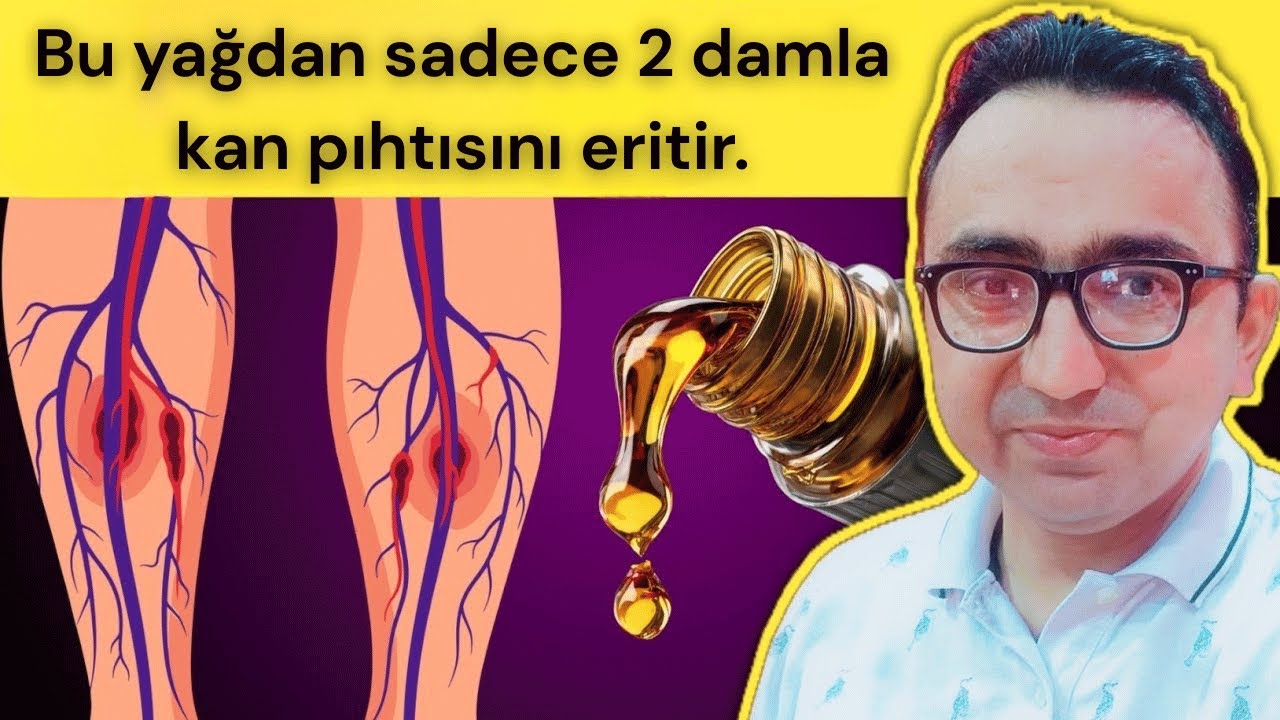 Damarlardaki Kan Pıhtılarını Eritip Kan Akışını Doğal Yollarla İyileştiren En İyi Yağlar!