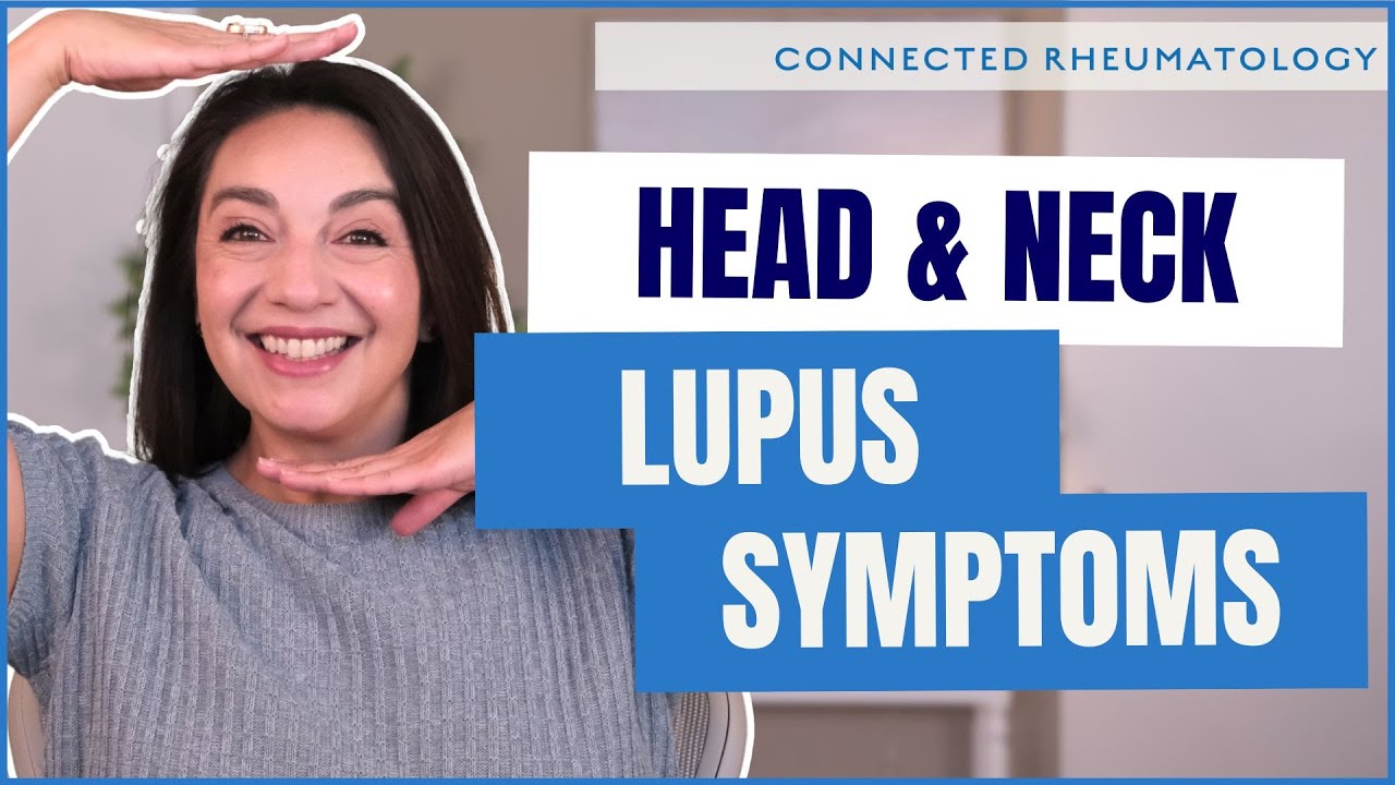 Above the Shoulders Lupus Symptoms Your Doctor May Miss