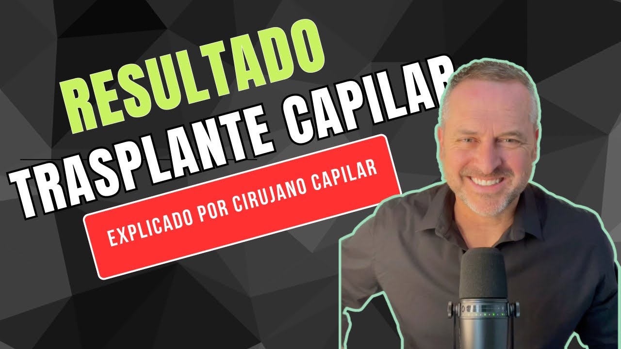 👌 TRASPLANTE CAPILAR: CASO CLÍNICO PROCESO Y RESULTADO | Explicado por cirujano capilar