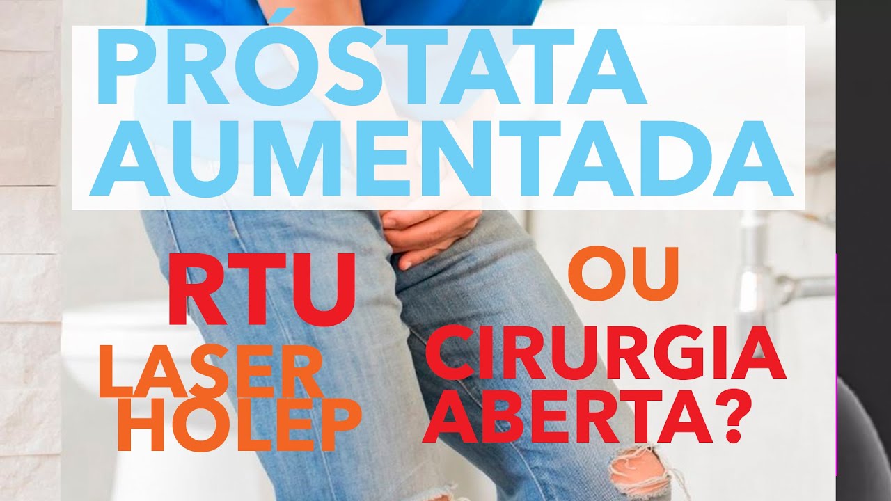 Hiperplasia Prostática e o MiLEP: a evolução do HoLEP no tratamento com laser (versão estendida)