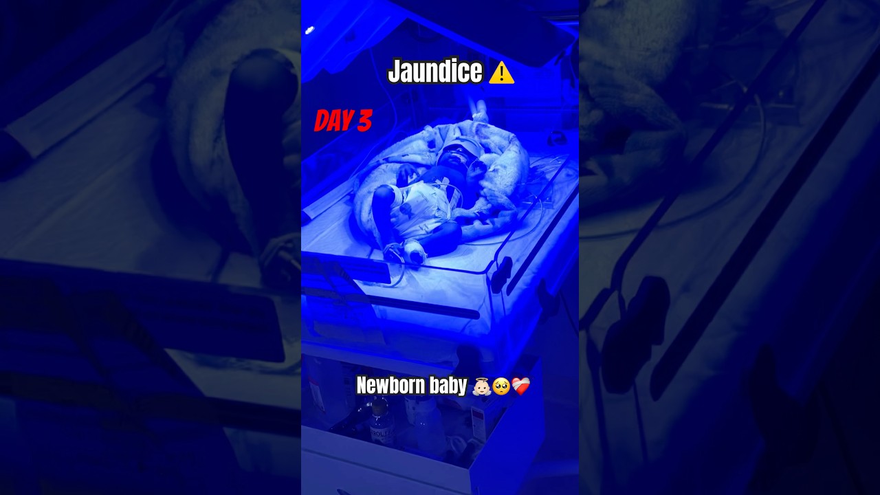 Critical condition, disease jaundice + RDS #nicucare #neonatologist #cutebaby #views #viral #newborn