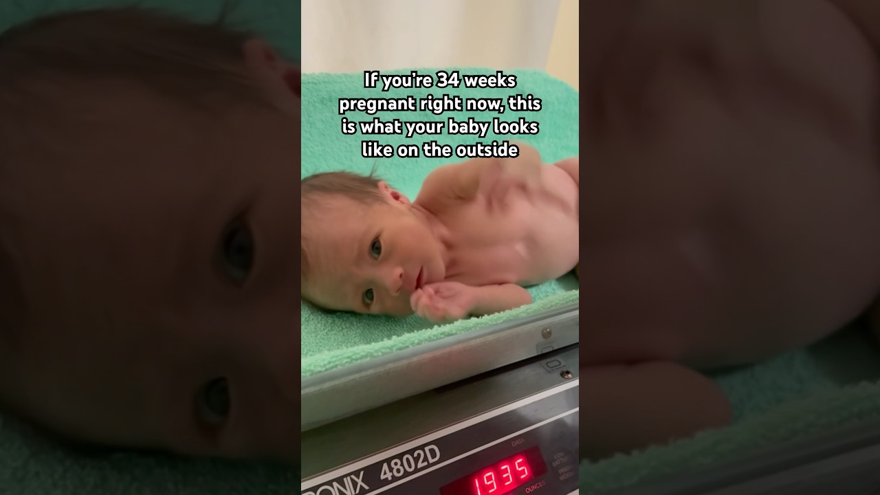 She was 2kg measuring 34weeks born at 37weeks #iugr #preemie #smallbaby #nicu #newborn #babyshorts