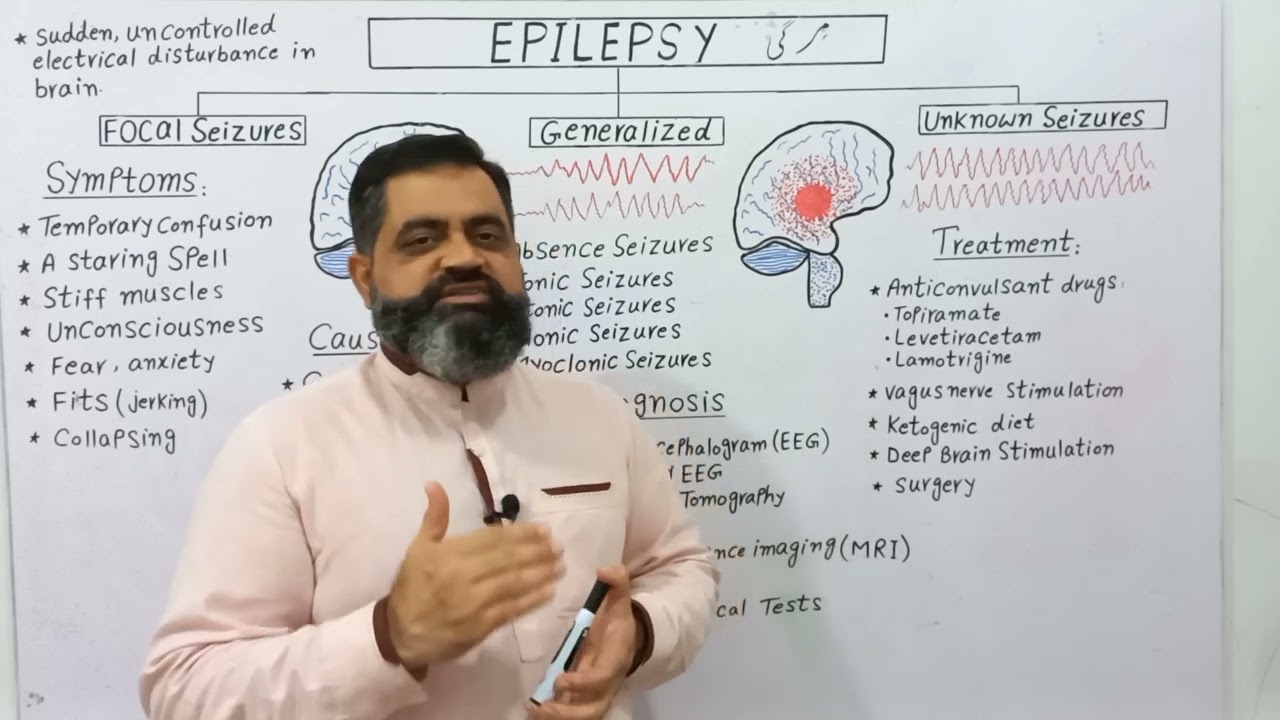 Epilepsy Urdu/Hindi Medium @prof.masoodfuzail| Seizures #epilepsy #epilepsysymptoms #epileptic
