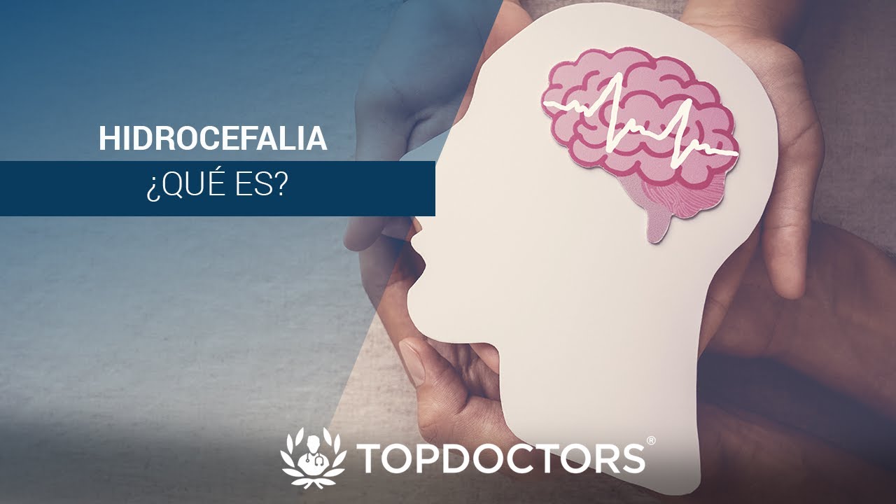 Hidrocefalia ¿Qué es?