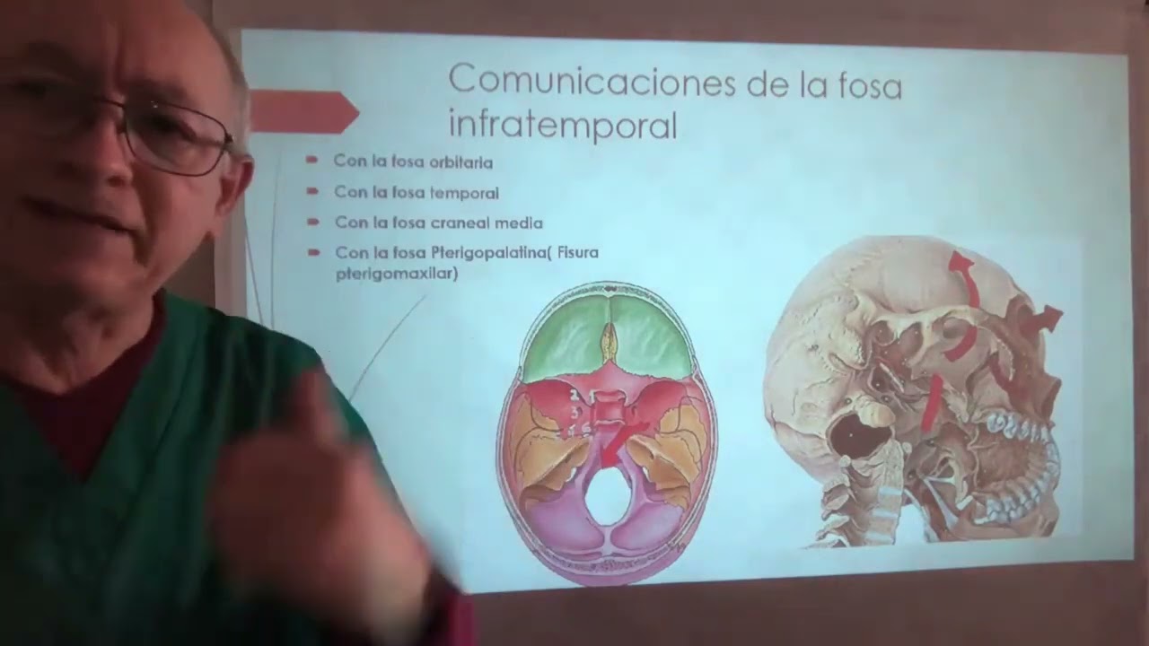 Nervios y arterias de la fosa infratemporal. Anatomia topografica paso a paso