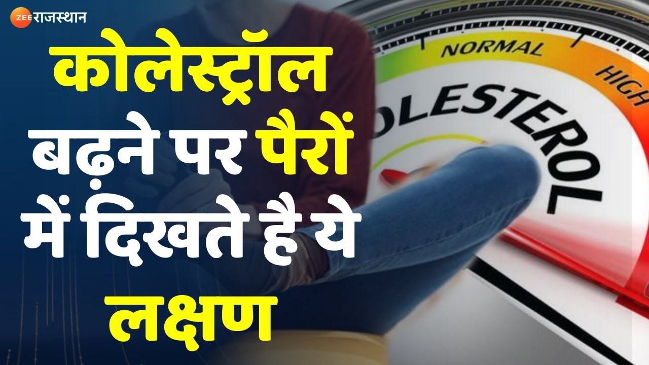 Hume Fikr Hai Aapki Live : Cholesterol बढ़ने पर पैरों में दिखते है ये लक्षण, जानें एक्सपर्ट्स से