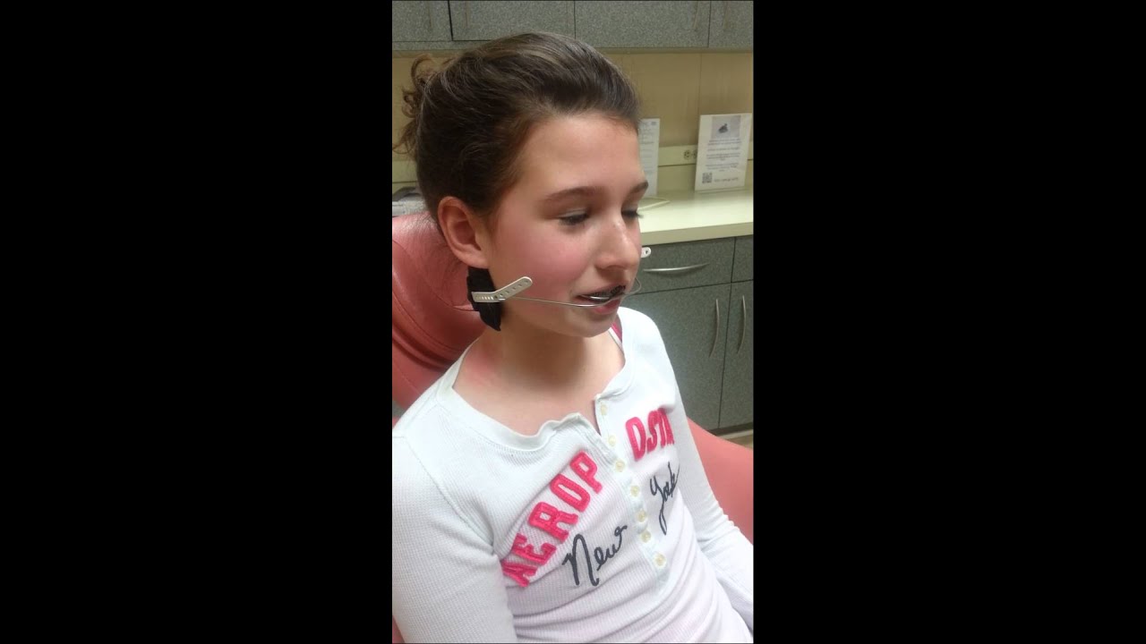 Dr Rebecca Falsafi Orthodontics - Head Gear Testimonial