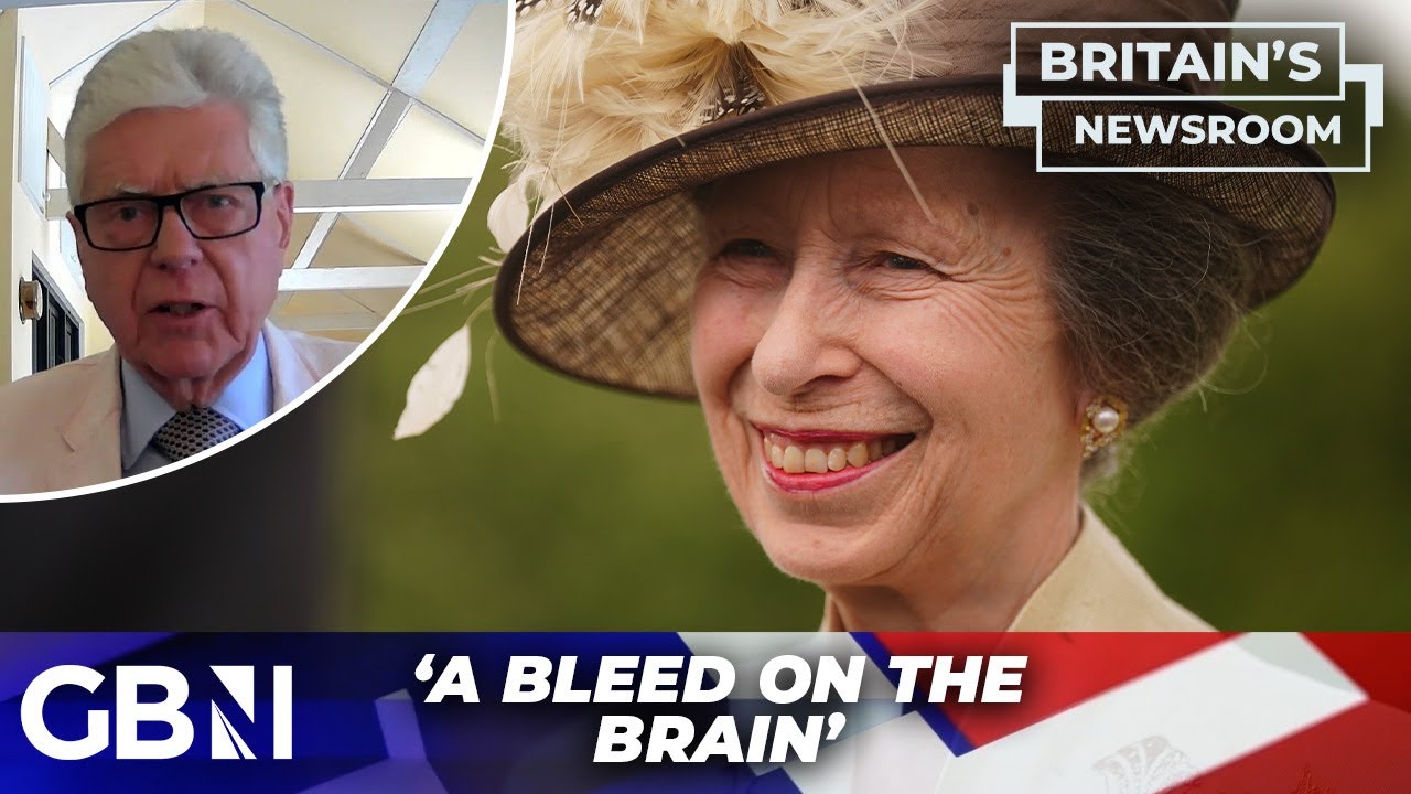 Princess Anne could have  'bleed on the brain': 'Concussion is NOT a minor matter'