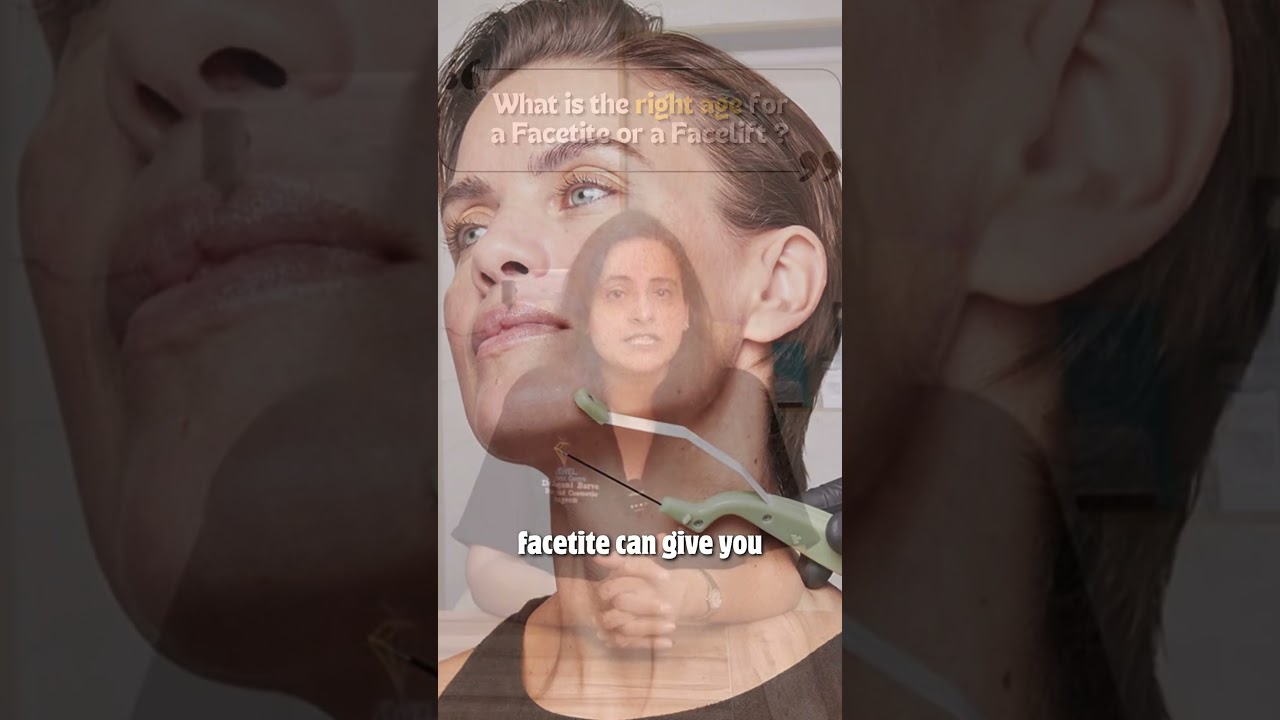 There’s no ‘perfect age’ for FaceTite or a facelift