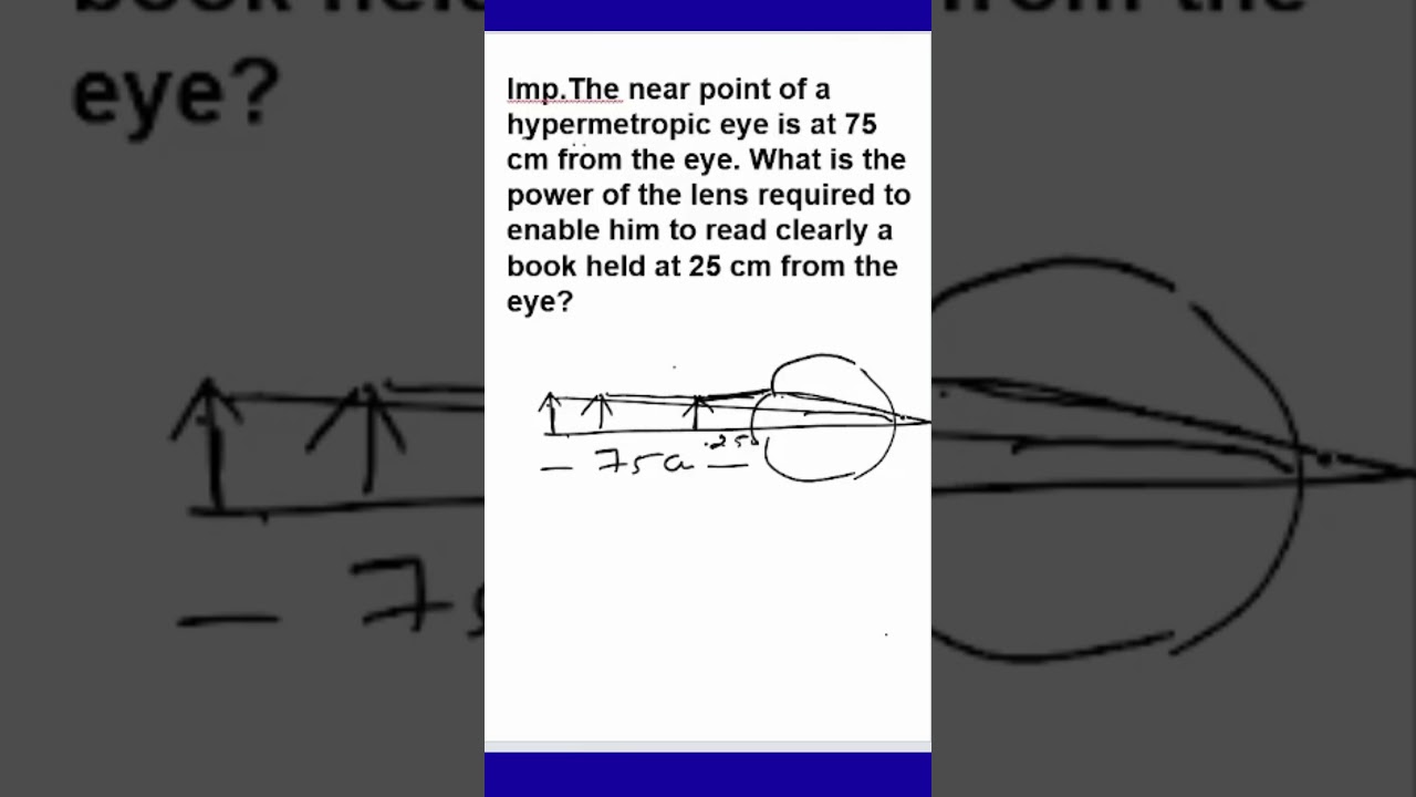 The Near Point | Hypermetropic Eye at 75 cm | Power of the Lens? | A Book at 25 cm from the eye