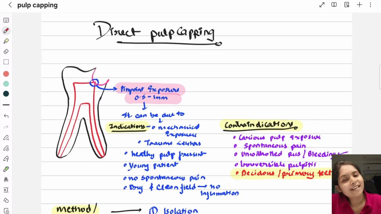 Direct pulp capping | Endodontics lecture | core concepts | NEET MDS INICET 