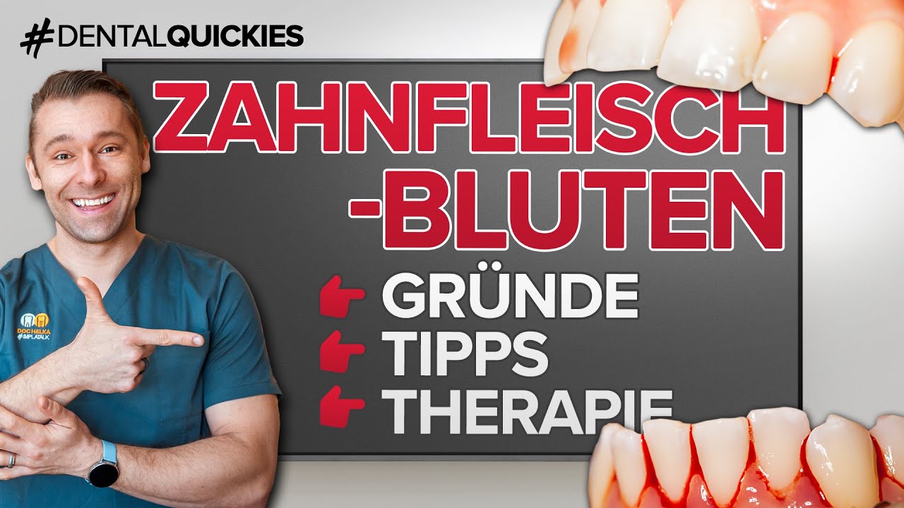 ZAHNFLEISCHBLUTEN - Ursache Therapie & Tipps ✅,  - So bekommst du es in den Griff!