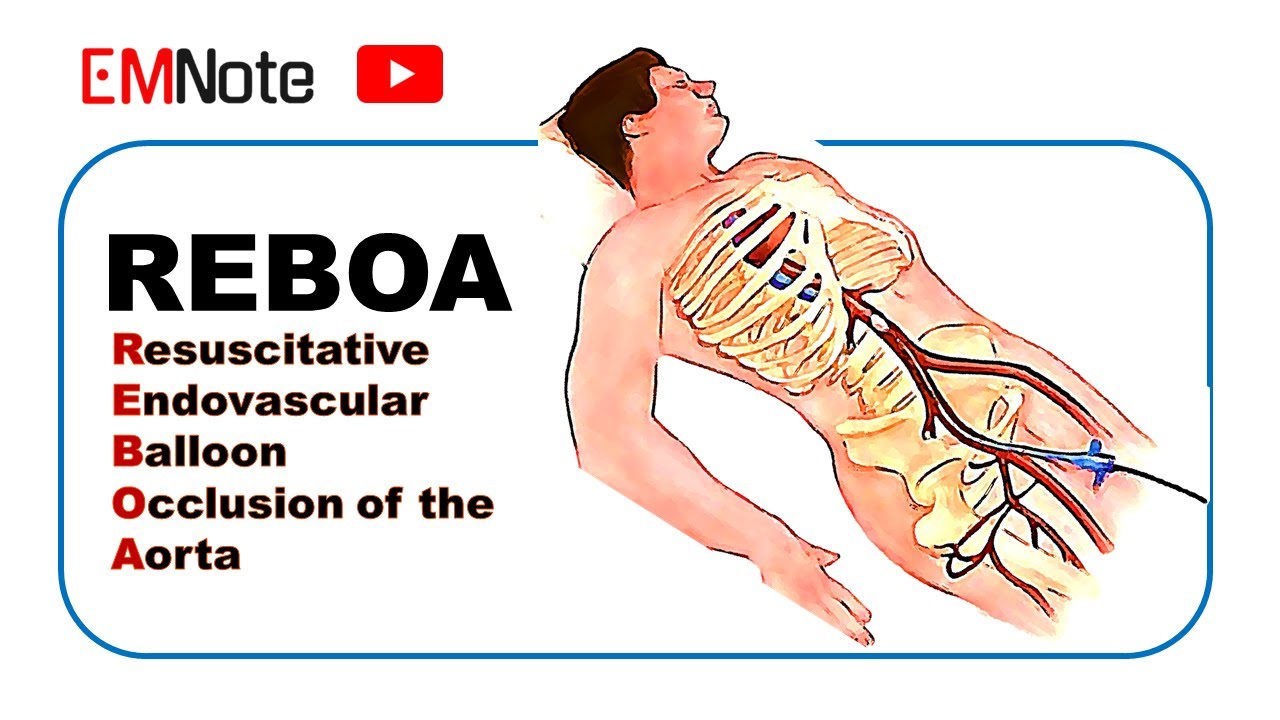 REBOA: Что, Почему и Как