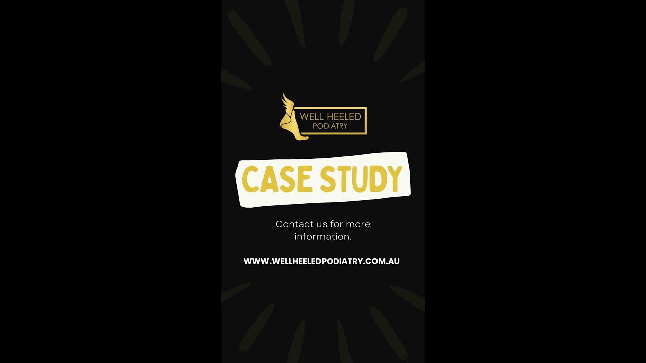 Ingrown Toenails Case Study