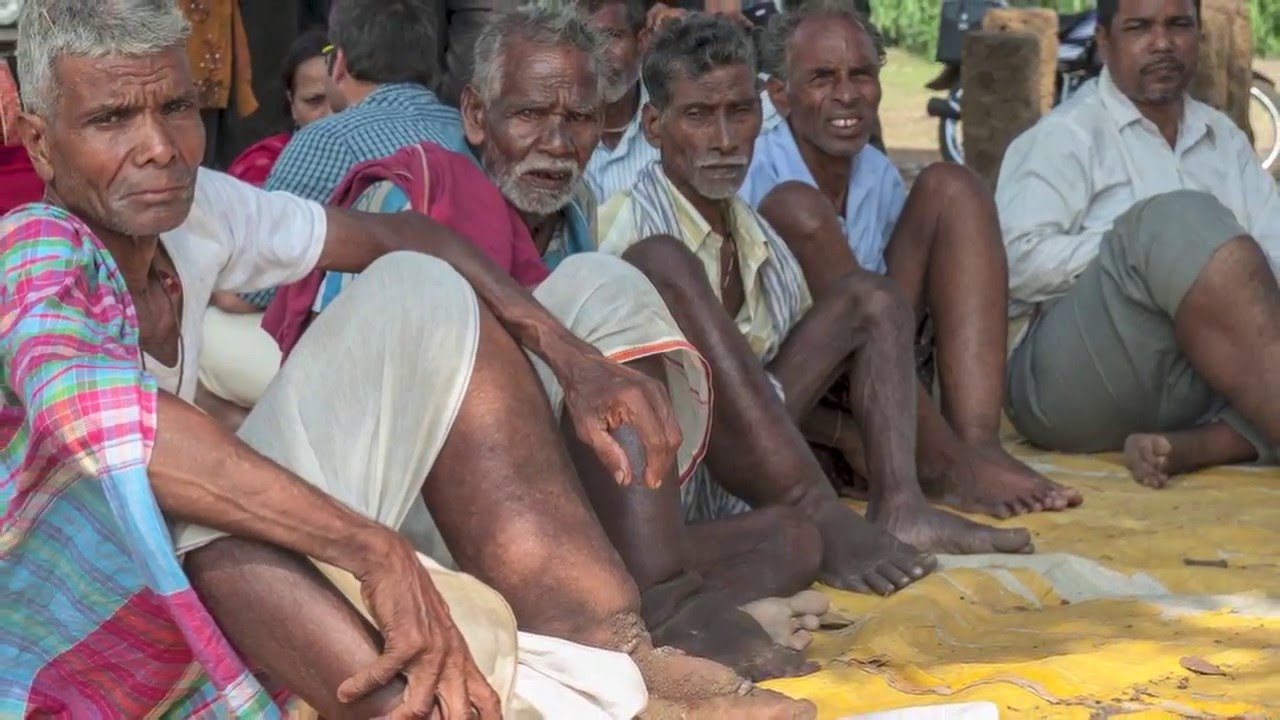 Tribute to Dr. V. Kumaraswami: Lymphatic Filariasis in Odisha, India