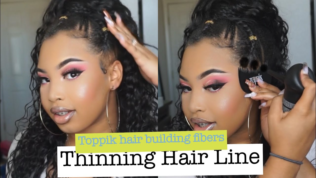 How I Fix My Thin Hairline using Toppik