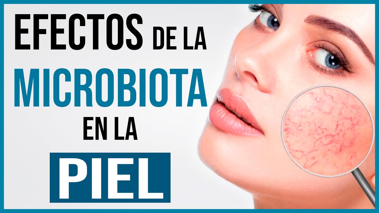 ¿Cómo afecta la Microbiota a las ENFERMEDADES DE LA PIEL?¡¡Descúbrelo!!