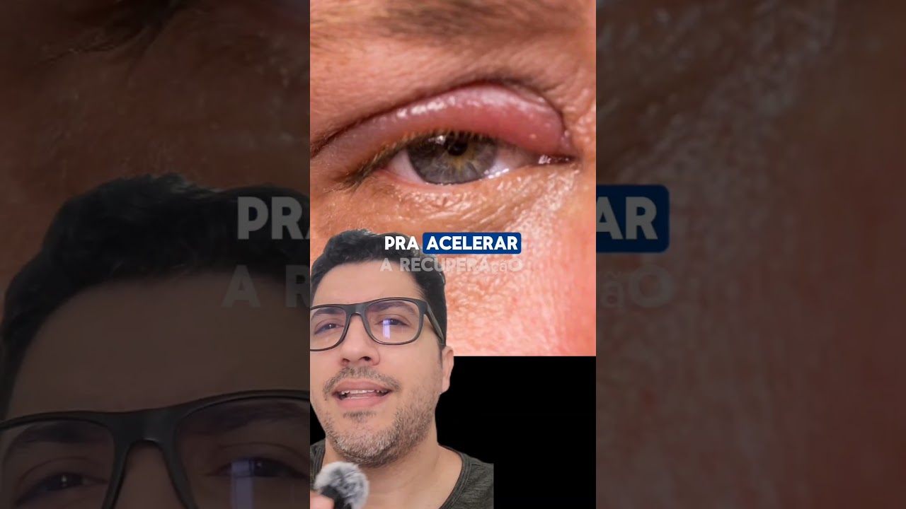 Ter&ccedil;ol ou Persol #curiosidades #saude #oticas otica