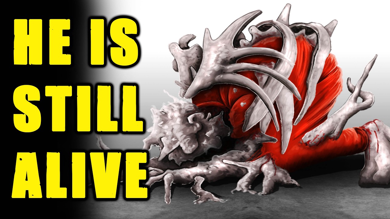 This is HORRIBLE! SCP-439 - The Bone Hive