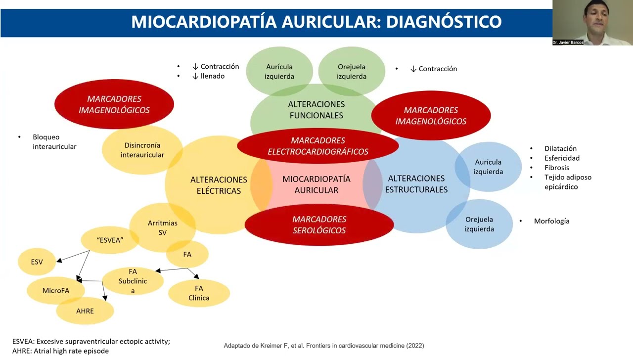 SIAC WEBINAR: Actualidades en Fibrilación Auricular. Un enfoque clínico
