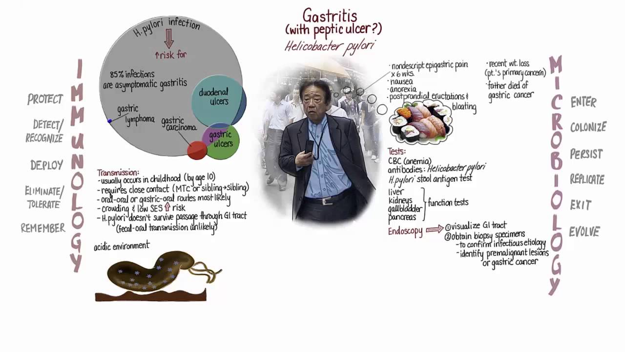 Gastritis: Springboard