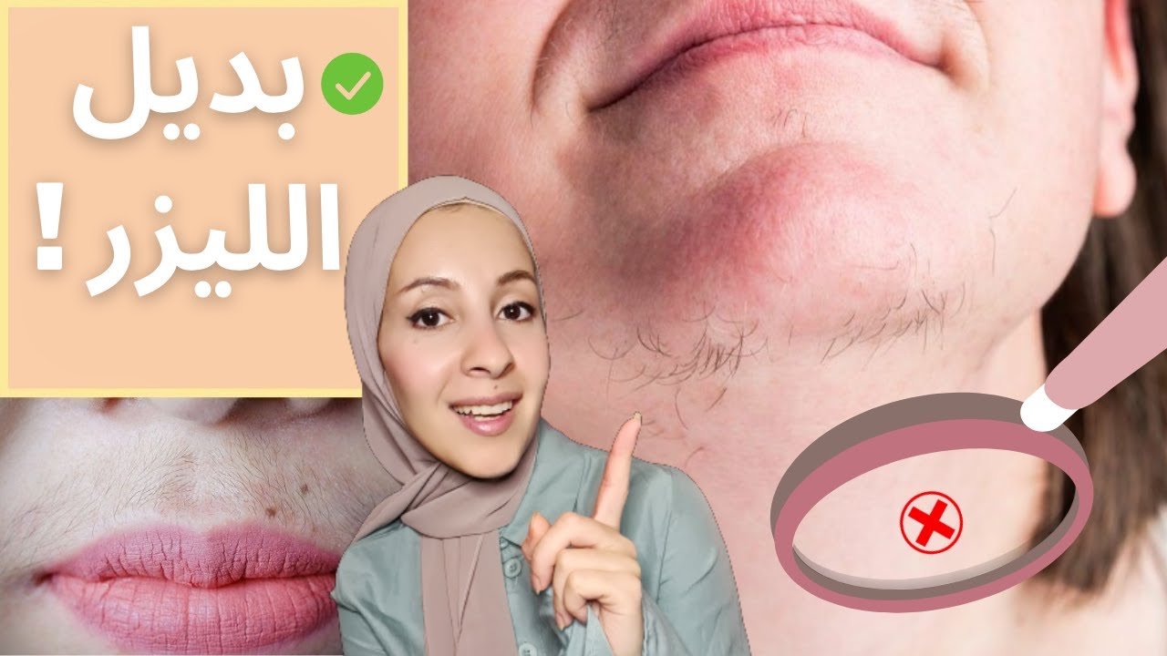 التخلص من الشعر الزائد { بدون ليزر} ولا عمليات تجميل | REMOVE UNWANTED HAIR