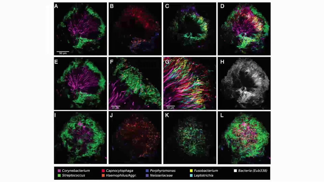 Ecological Diversity in the Microbiome - Kyle Bittinger PhD