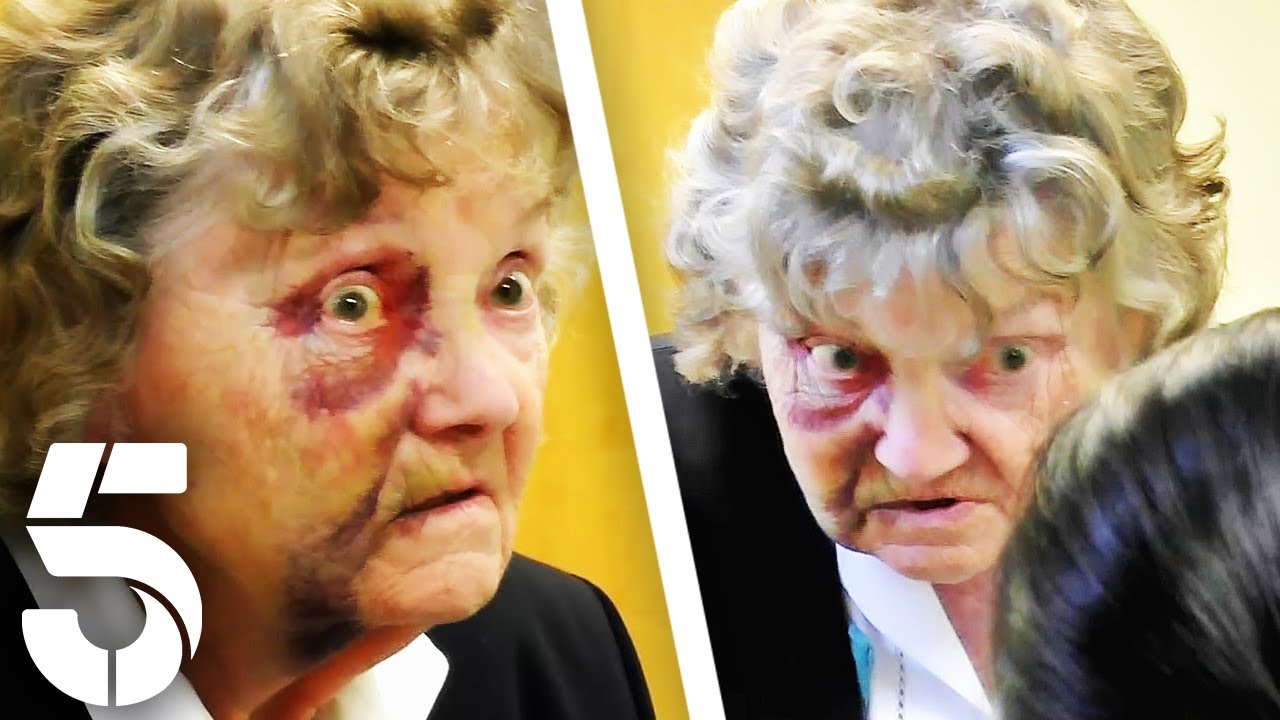 Painful Bruising On The Face | GPs: Behind Closed Doors | Channel 5