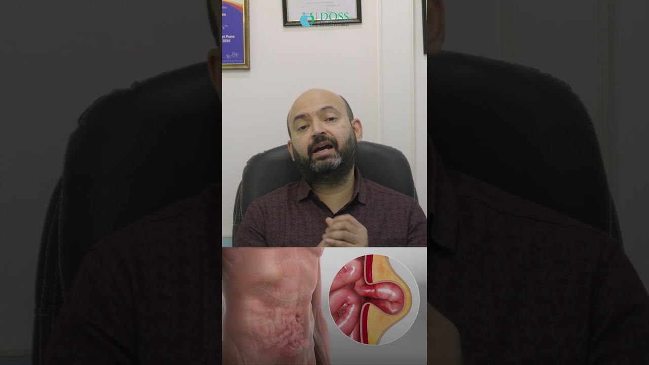 What Happens When Hernia Gets Complicated? | Dr Neeraj Rayate | DOSS India