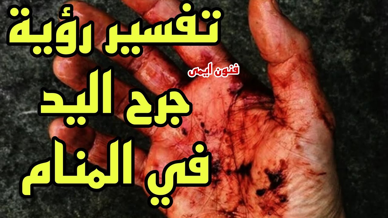 تفسير رؤية جرح اليد في المنام لابن سيرين للرجل والمرأة | تفسير الاحلام لابن سيرين