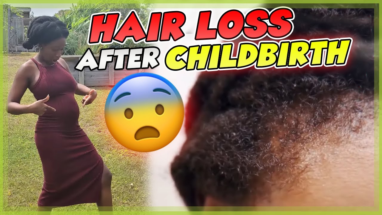 Postpartum Shedding on Natural Hair &ndash; Why it happens