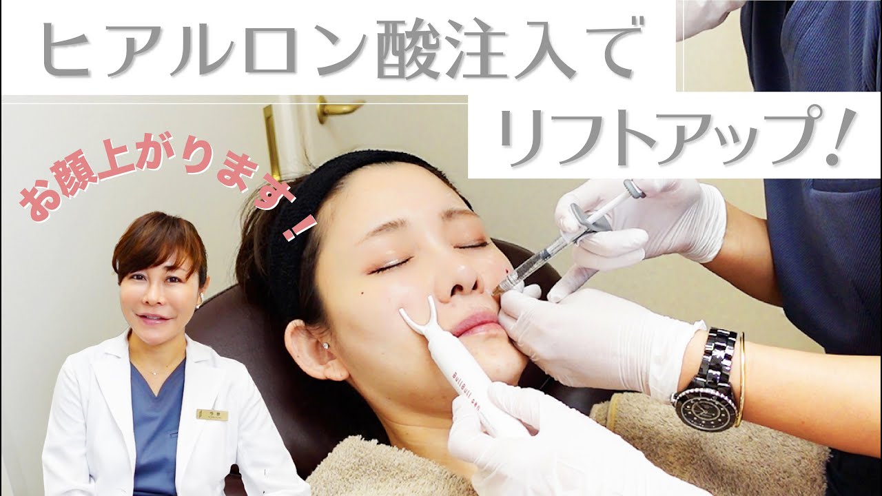 【ヒアルロン酸施術シーンあり】注射だけでリフトアップ！お顔が上がります