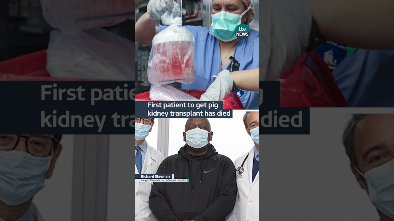 First patient to get pig kidney transplant has died 