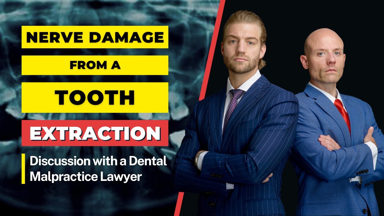 Can Tooth Extraction Cause Nerve Damage? | Discussion with a Florida Dental Malpractice Attorney