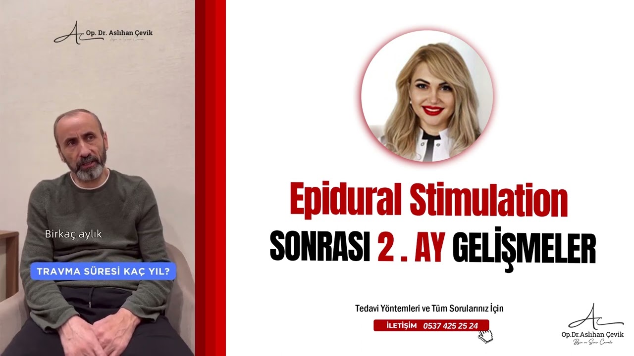 OMURİLİK FELCİ TEDAVİSİ 