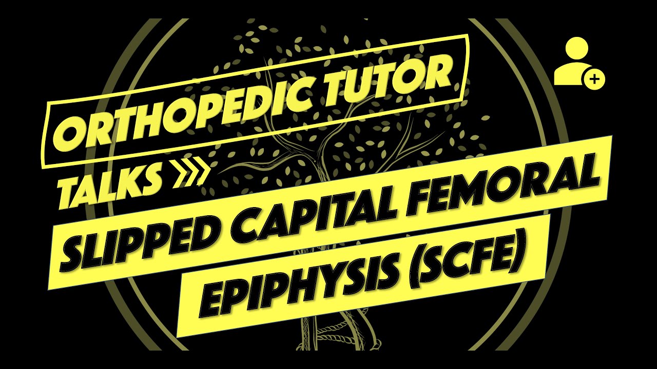 Slipped Capital Femoral Epiphysis (SCFE)