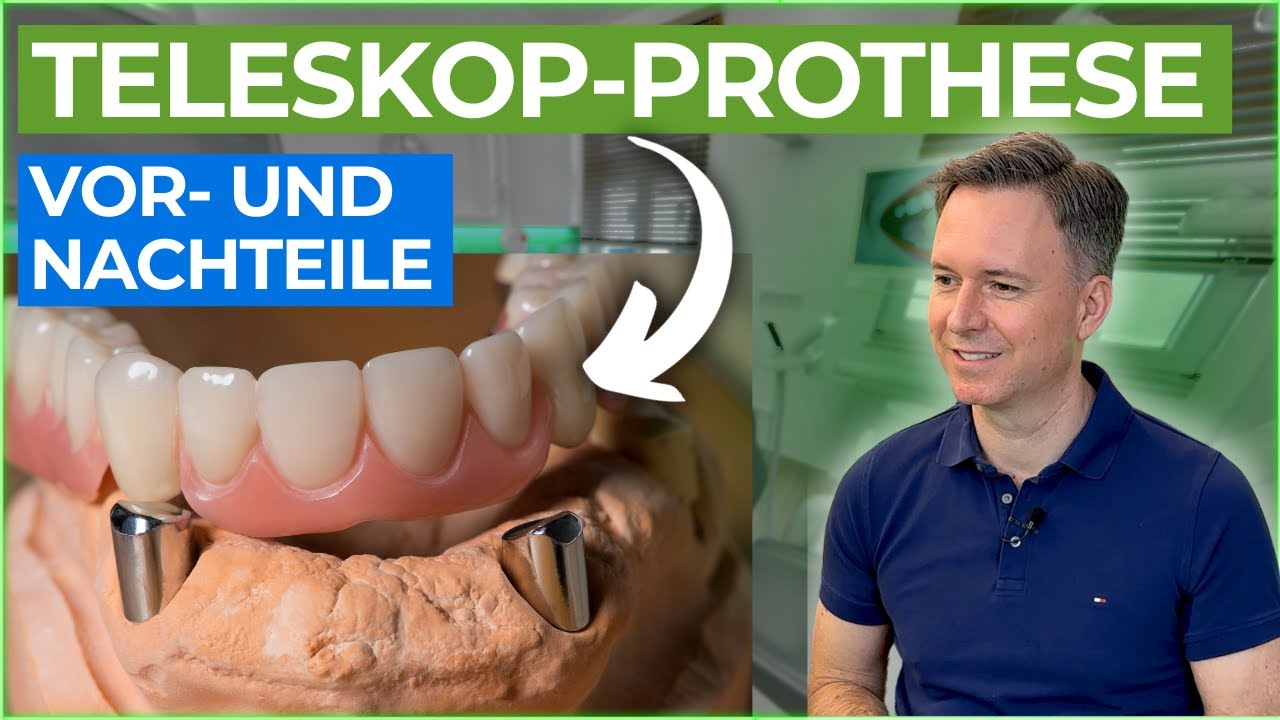 Erlebe den Komfort und die Ästhetik des Teleskop-Zahnersatzes