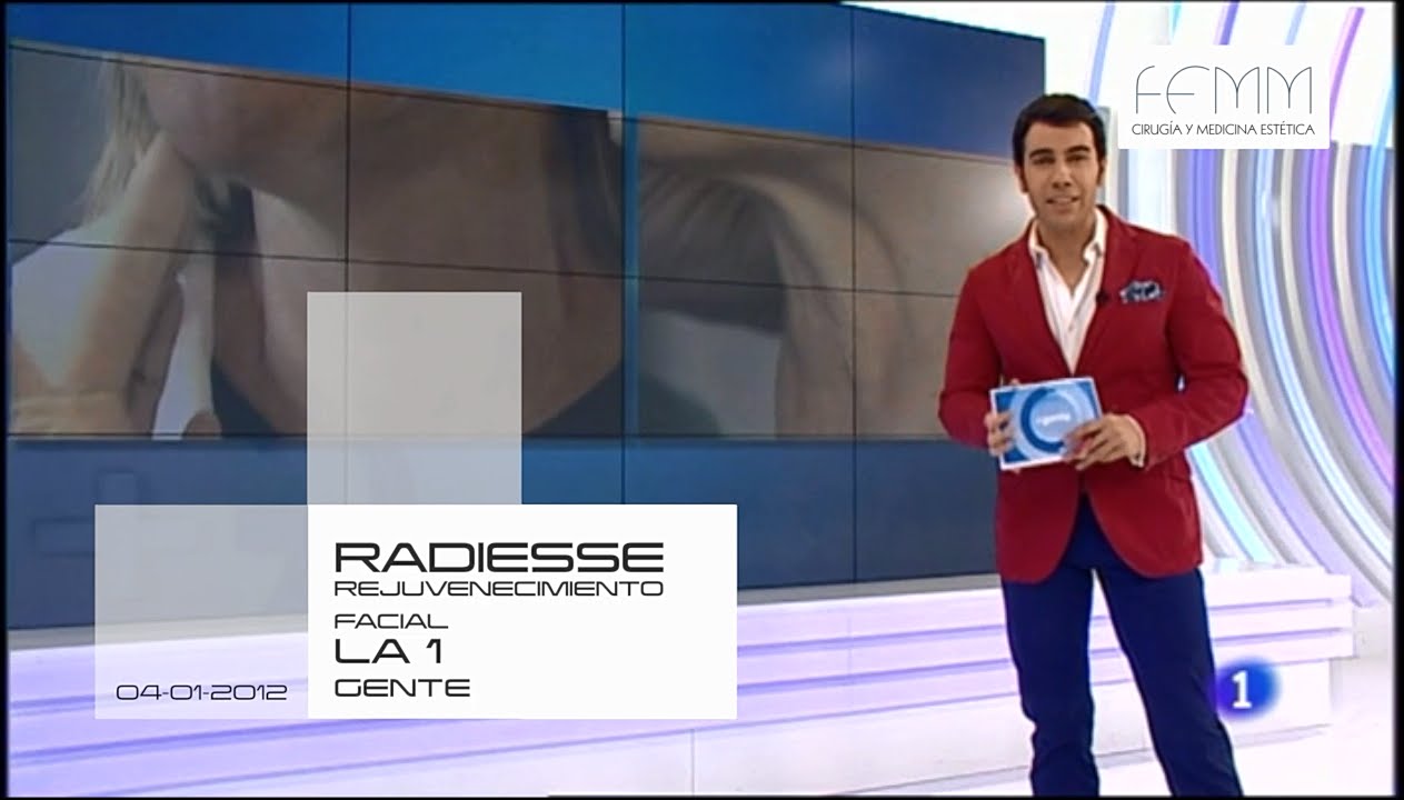 Rejuvenecimiento facial y del cuello. Radiesse. #estética