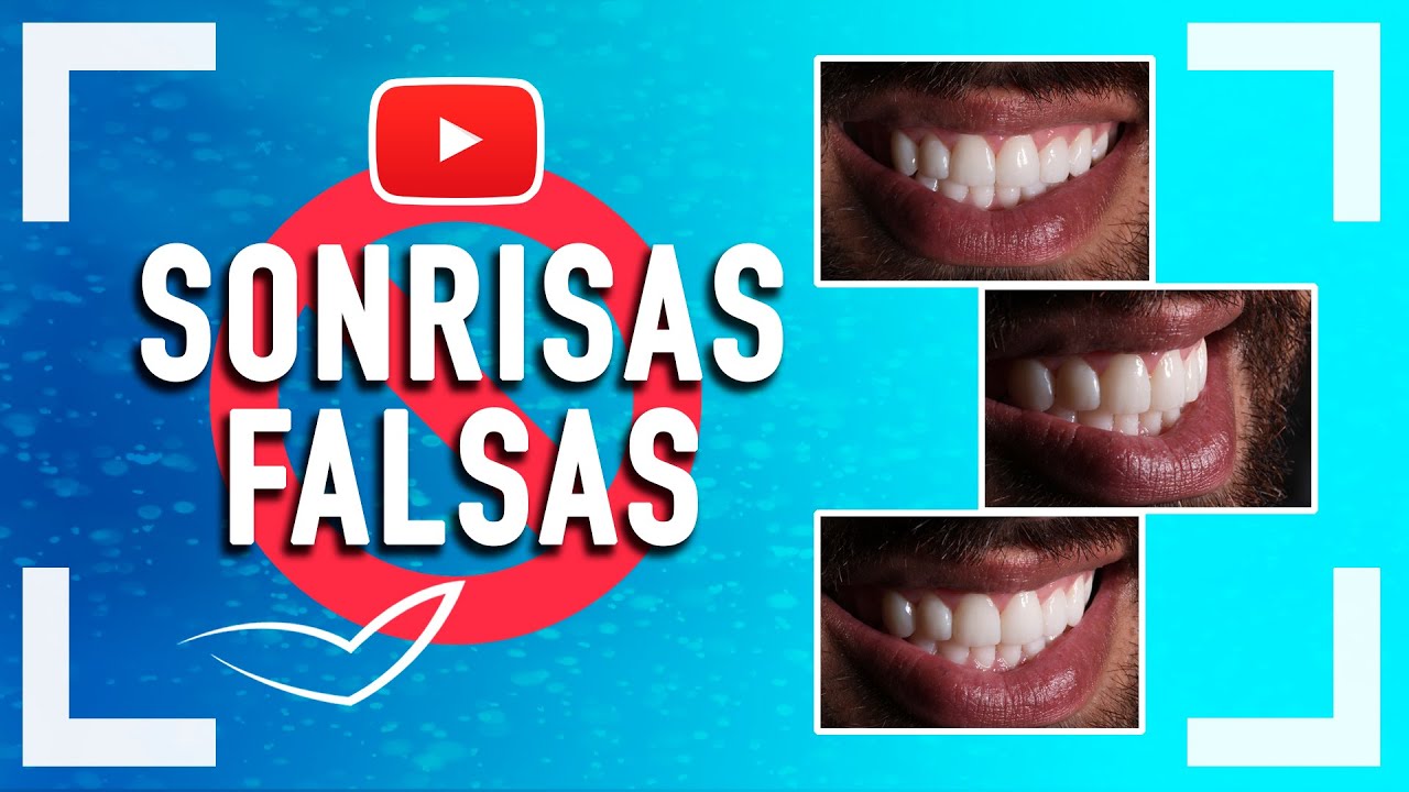 Diseño de Sonrisa Natural 😡 No más Sonrisas Falsas 💥💥