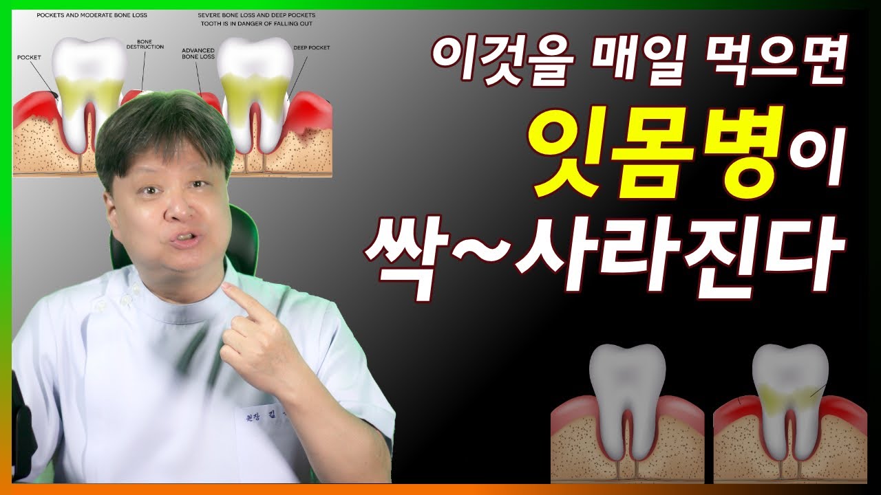 이것을 매일 먹으면 잇몸병이 싹사라진다. [한의학박사 김순렬]