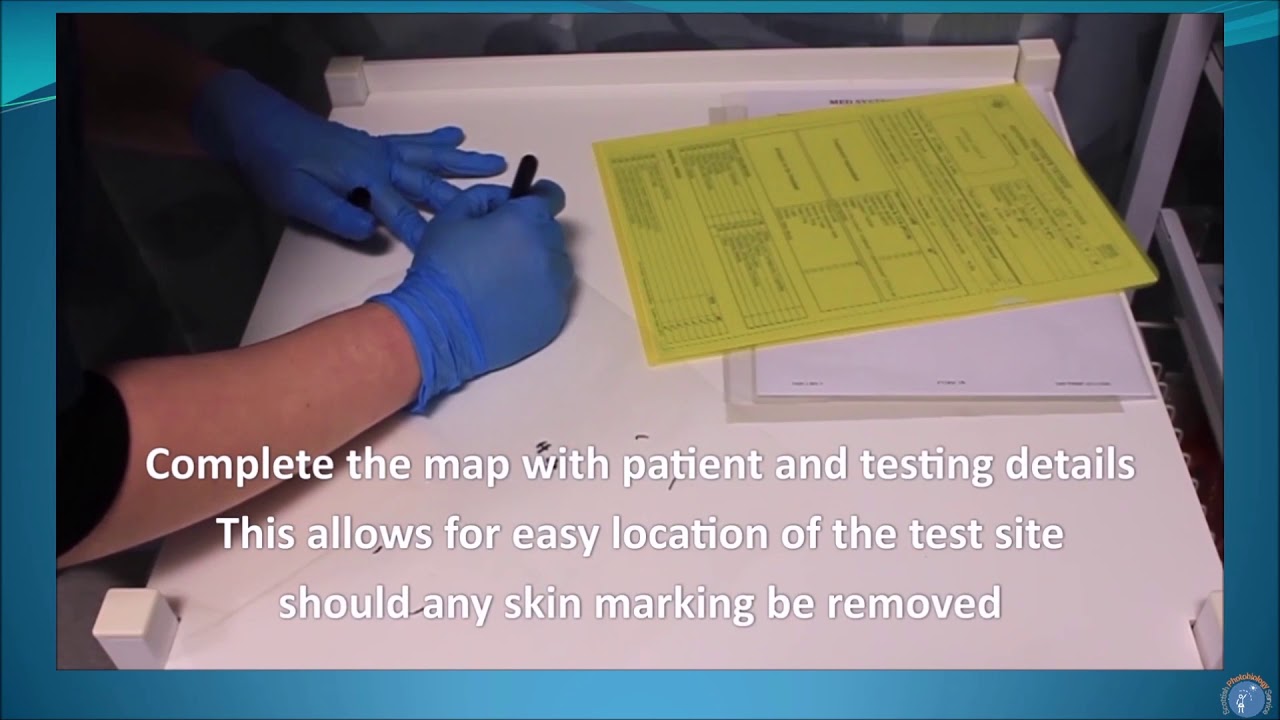 How to perform an Minimum Erythemal Dose (MED) test