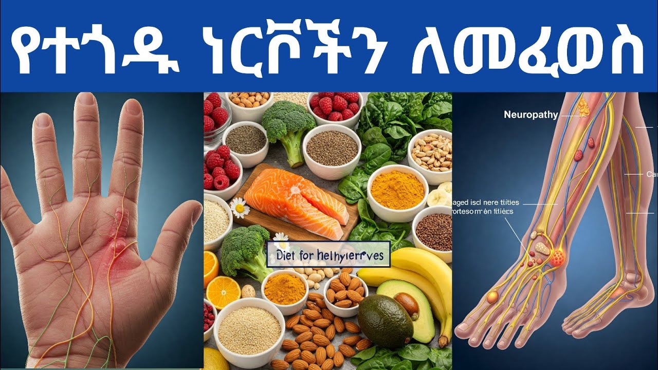 ለነርቭ ጥገና የሚሆኑ፤ የተጎዱ ነርቮችን ለመፈወስ የሚረዱ፤ የነርቭ በሽታን ለመከላከል የሚረዱ ምግቦች| Foods to Heal Damaged Nerves