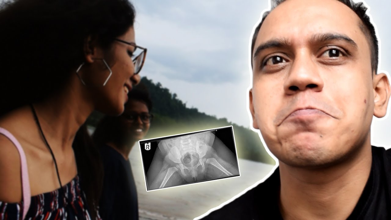 WE HAD TO GO TO THE EMERGENCY ROOM!!